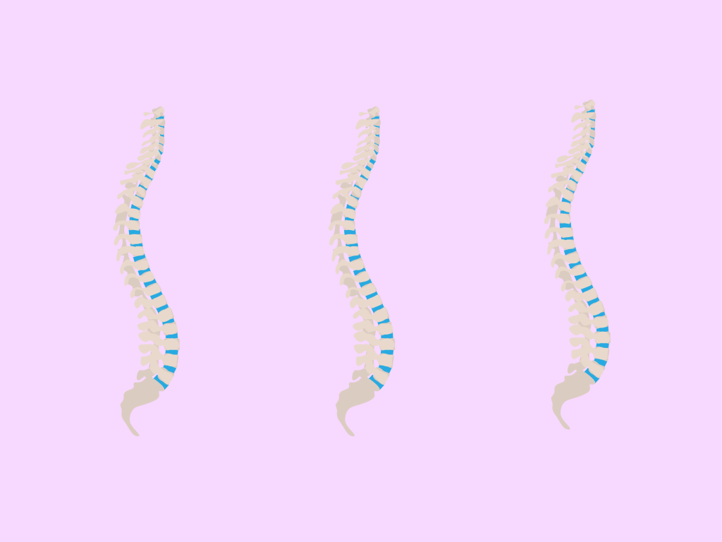 Light purple background with three identical, animated images of the bones of the spine. 