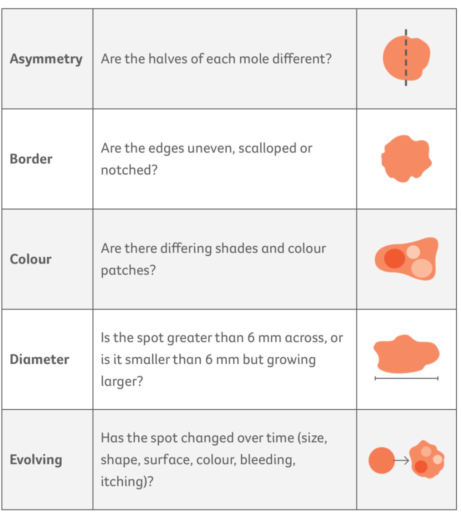 Table with three columns and 5 rows containing information on the what to look for in spots for skin cancer. 
Row 1: asymmetry: are the halves of each mole different?
Row 2: border: are the edges uneven, scalloped or notched?
Row 3: colour: are there differing shades and colour patches?
Row 4: diameter: is the spot greater than 6mm across or is it smaller than 6 mm but growing larger?
Row 5: evolving: has the spot changed over time (size, shape, surface, colour, bleeding, itching)?